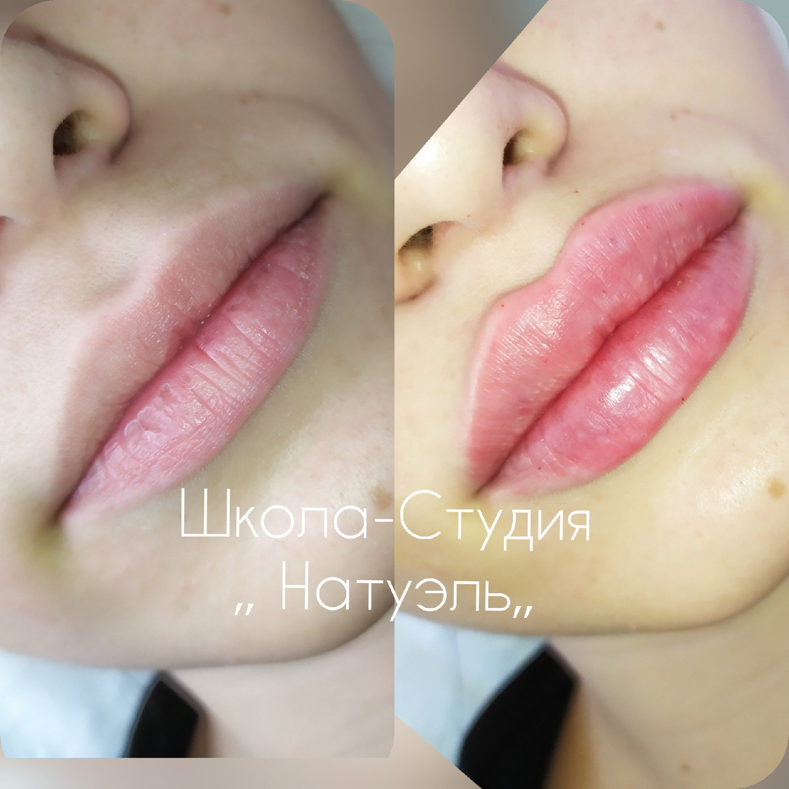 Перманентный макияж губ увеличенные филлерами