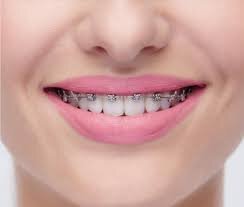 Сниженыценынабрекет-системы