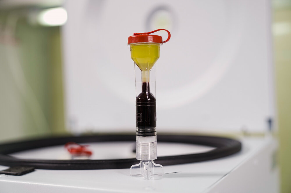 Пробирка для прп. Арм пробирки для prp терапии. Пробирка ycellbio-kit. Пробирка ycellbio-kit для prp. Пробирка «ycellbio-kit» для prp- терапии.