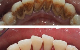 фотография работы врача Ирины Викторовны Бекаевой