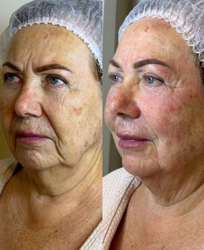 фотография работы Клиники современной косметологии Esteeskin Clinic