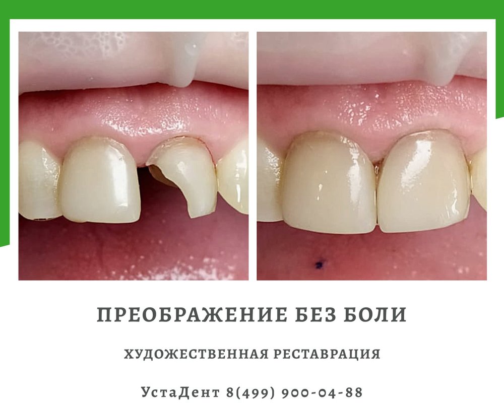 фотография работы Стоматологии УстаДент на метро Яхромская