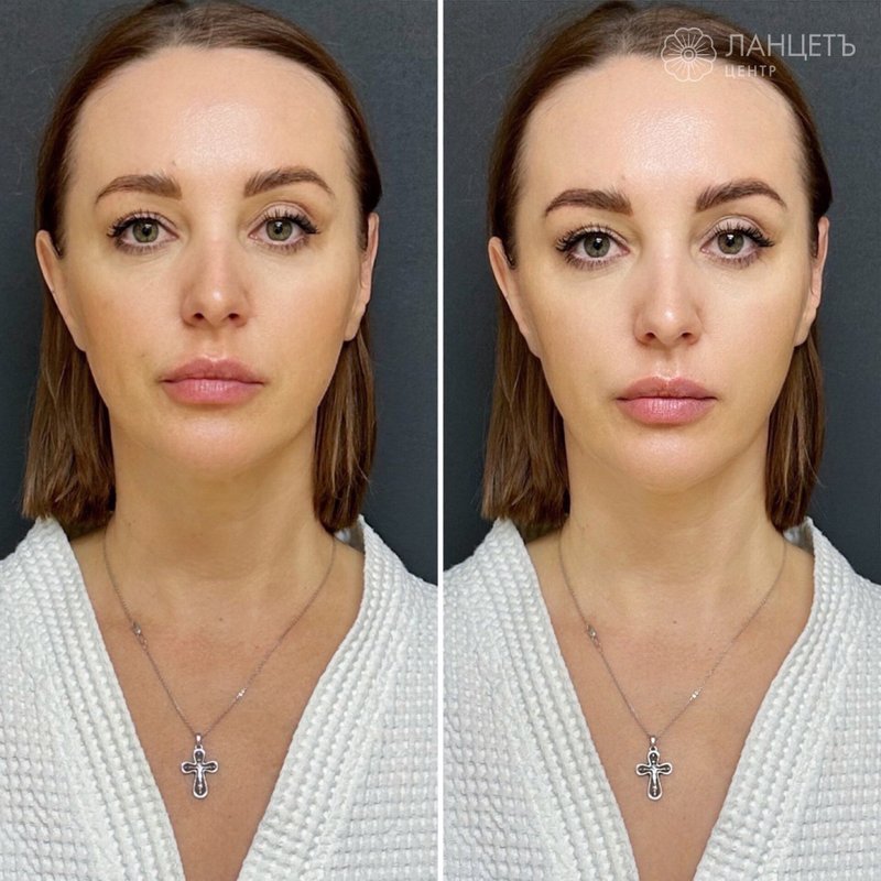 фотография работы Клиники косметологии Ланцетъ-Центр на улице Спиридоновка