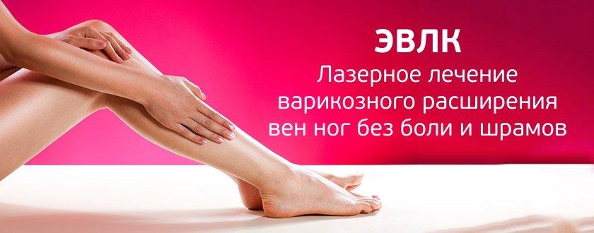 удаление варикоза по полису омс.