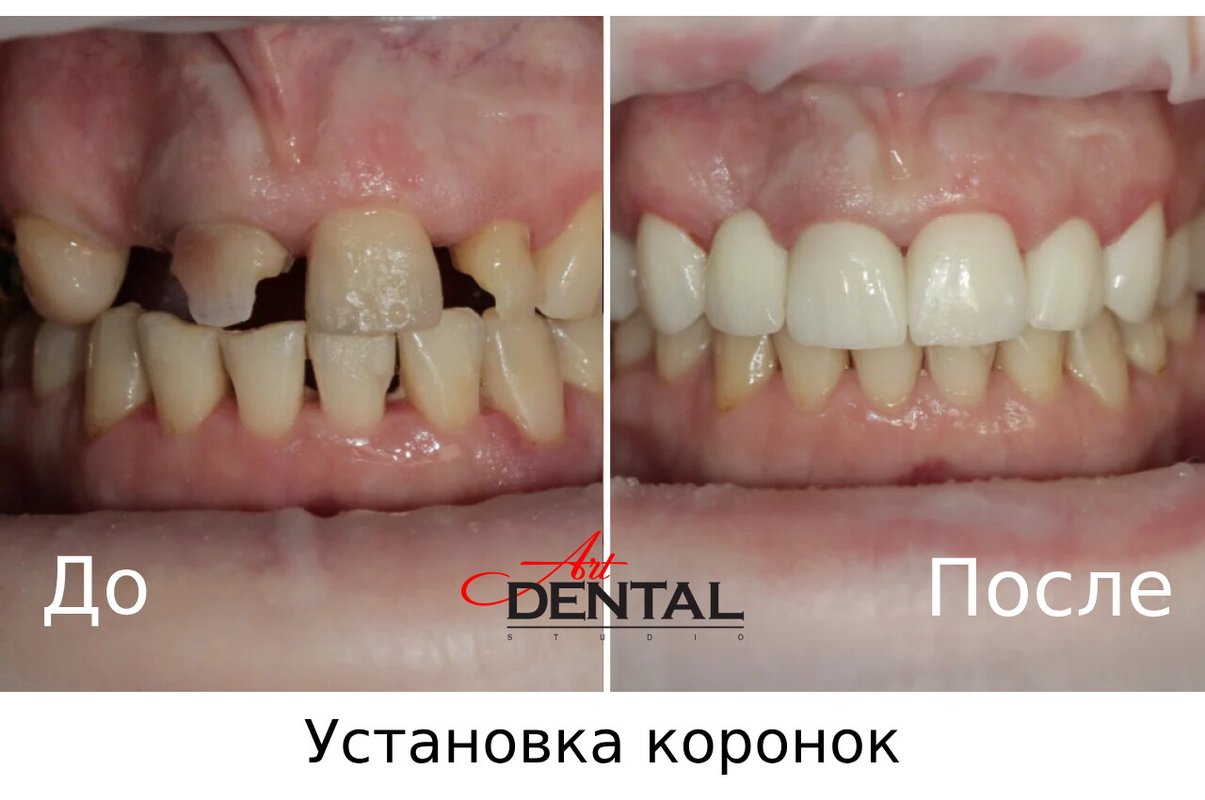 фотография работы Стоматологии Art Dental Studio на улице Маршала Тухачевского, 58 к 3