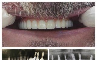 фотография работы врача Габриэля Михайловича Хамицева