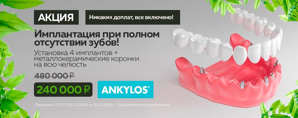 Имплантация зубов «под ключ» Томск Узбекский Зубной мост Томск Яковлева