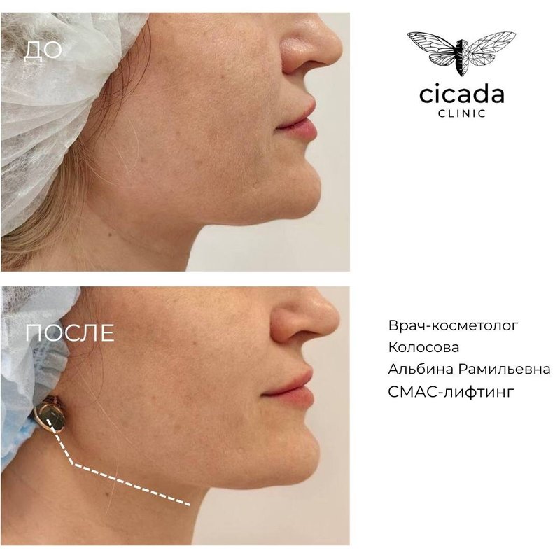 фотография работы Клиники инновационной косметологии Cicada Clinic