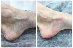 Клиника эстетической и антивозрастной медицины AMN Persona, с рейтингом 2.3 - находится по адресу Екатеринбург, проспект Ленина, 22а 