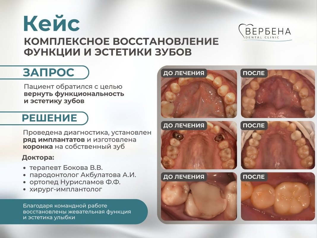 фотография работы Стоматологии Вербена на улице Рихарда Зорге
