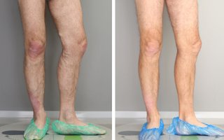фотография работы врача Андрея Васильевича Чупеева