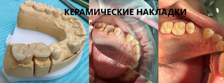 фотография работы Стоматологии Дент Сервис в Ясенево