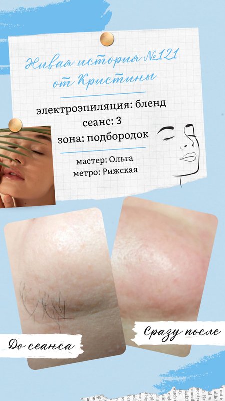 фотография работы Центра эпиляции Вселенная красоты на Трифоновской улице