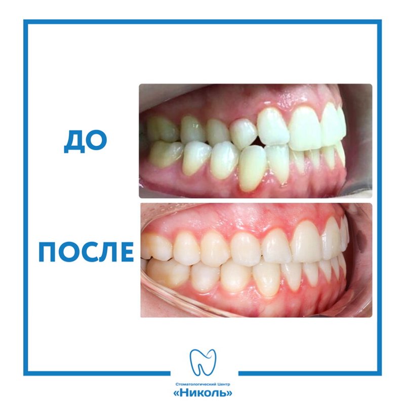 фотография работы Стоматологии Николь у метро Беговая