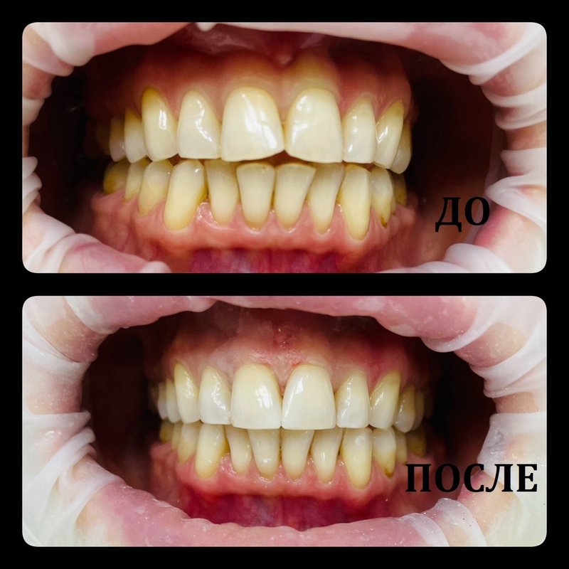 фотография работы Стоматологической клиники New Smile