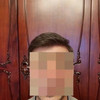 фото от пользователя Клементий  в отзыве о клинике пересадки волос GGmed
