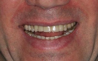 фотография работы врача Сергея Анатольевича Лабаня