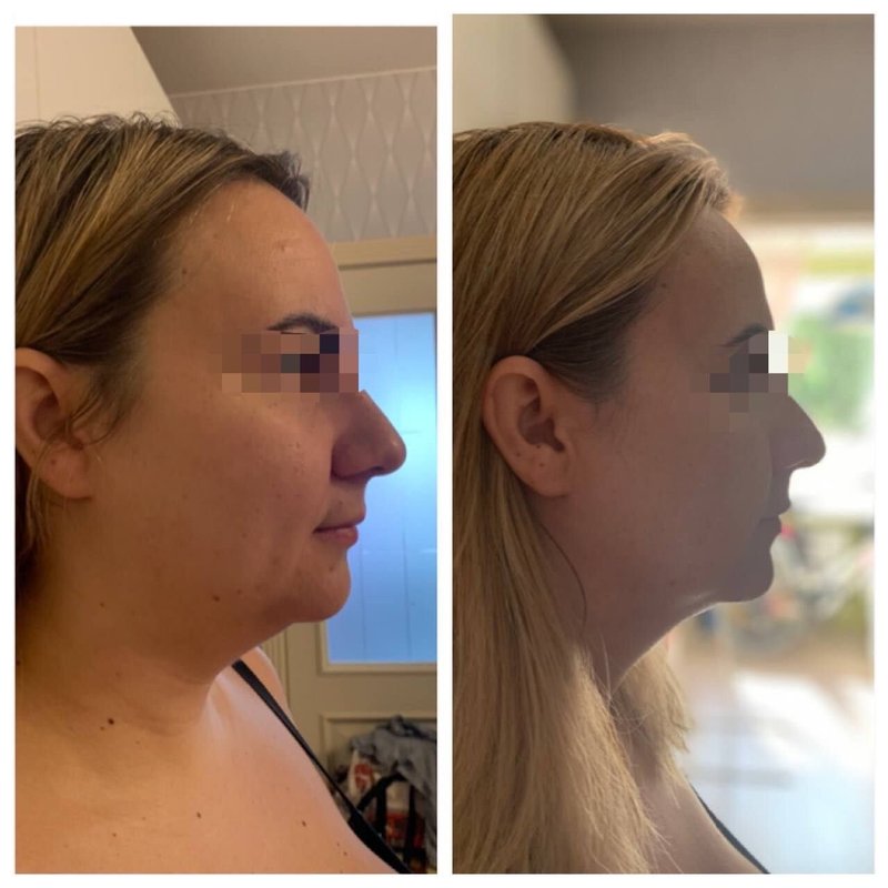 Студия массажа Торрес на Автозаводской улице - отзывы о салоне красоты ...