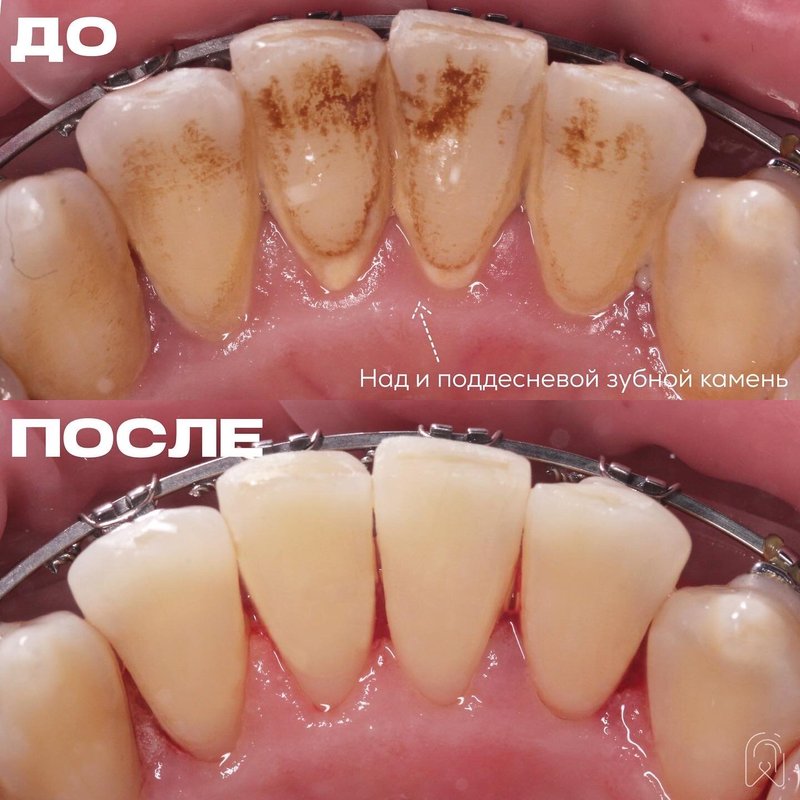 фотография работы Стоматологической клиники Дентал Макс на Окской улице