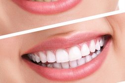 Стоматология Медсервис Профи, с рейтингом 2.3 - находится по адресу Краснодарский край, Анапа, улица Лермонтова, 116г 