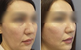фотография работы врача Марины Анатольевны Четвериковой