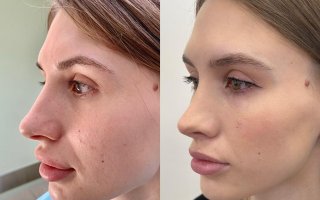 фотография работы врача Дмитрия Олеговича Васильева