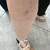фото от пользователя Anna Chaplina в отзыве о клинике лазерной эпиляции Подружки на метро Проспект Вернадского