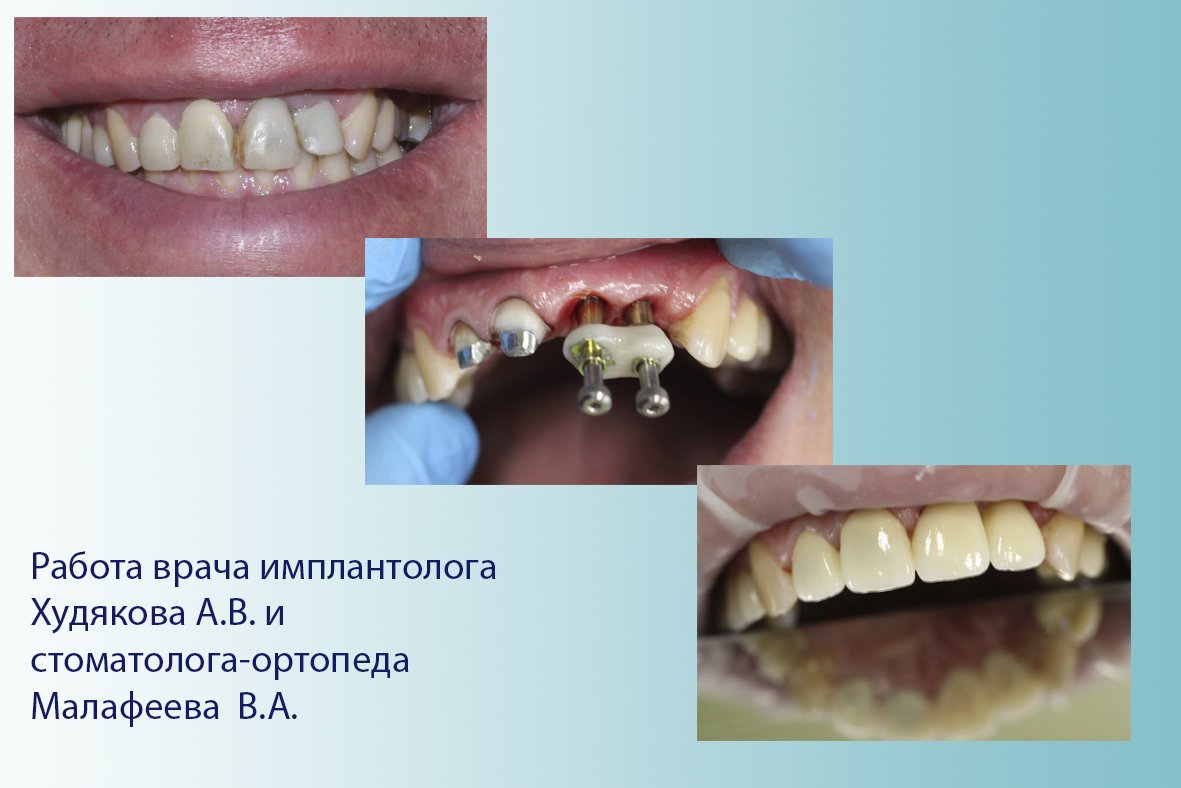 фотография работы Стоматологической клиники Айсберг+ на улице Доблести
