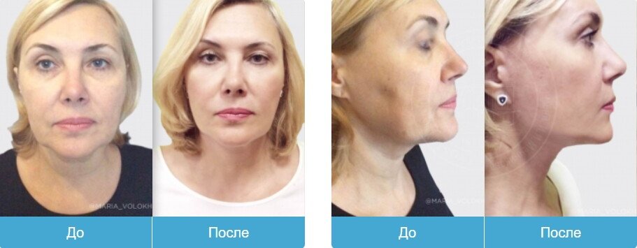 фотография работы Клиники эстетической медицины DEGA в Невском районе