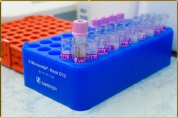 Медицинский центр Invitro, с рейтингом 2.4 - находится по адресу Москва, 9-я Парковая улица, 8 ст1 