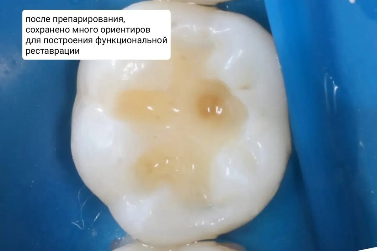 фотография работы Центра имплантации Терюховых на Никитской улице