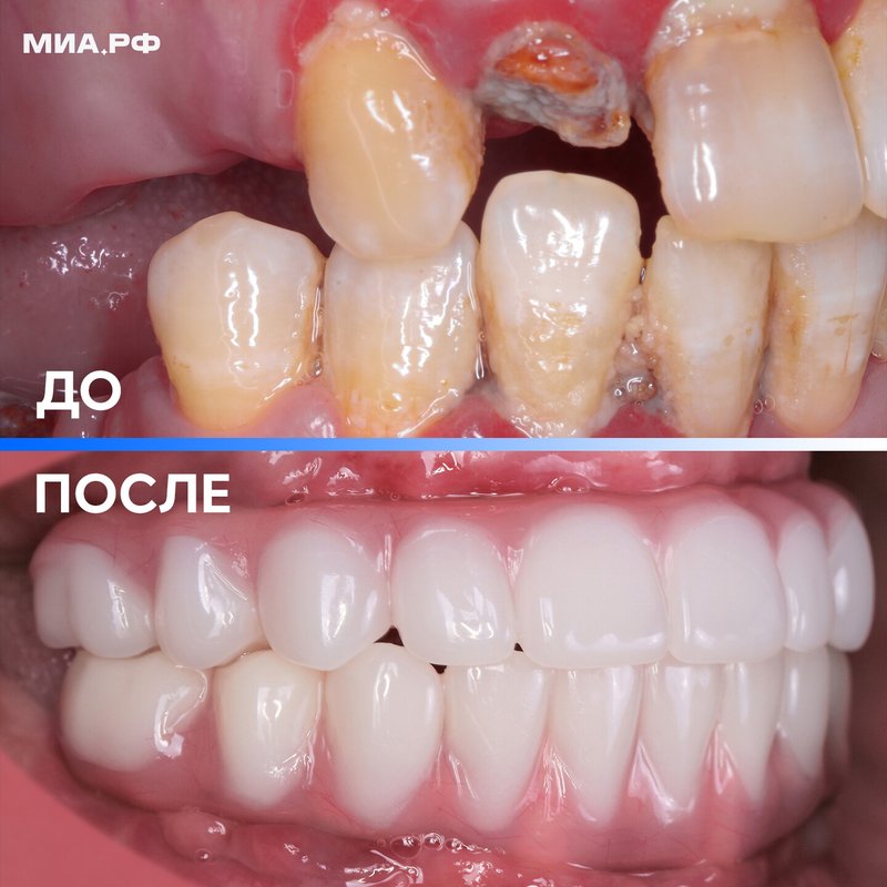 фотография работы Центра имплантации и стоматологии МИА.РФ на метро Рижская