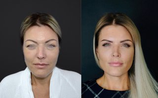 фотография работы врача Андрея Евгеньевича Копасова