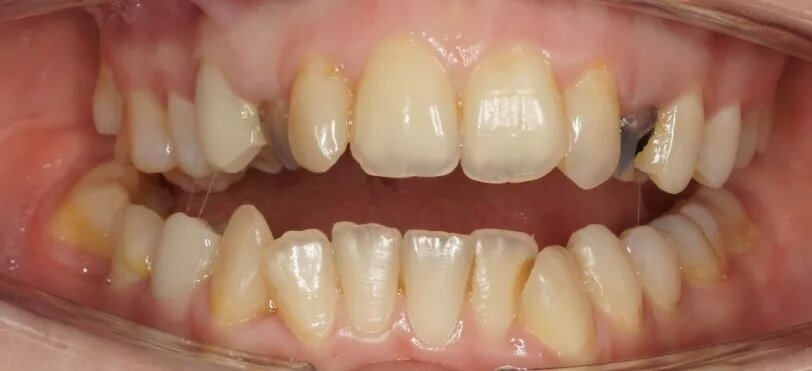 фотография работы Стоматологической клиники DENTBLANC на Мичуринском проспекте