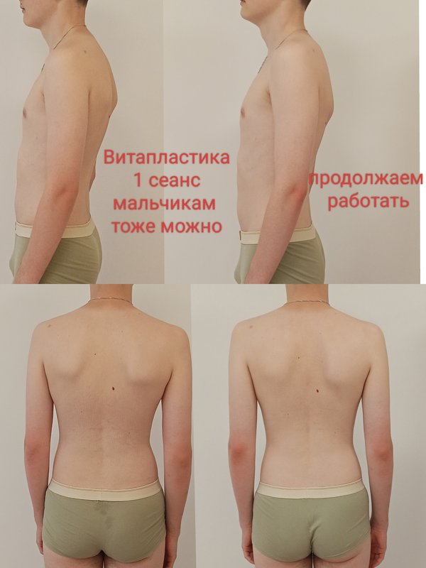 фотография работы Минус пять - Волшебство Витапластики