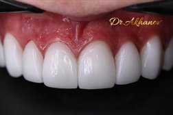 Стоматологический центр Ast.dent, с рейтингом 4 - находится по адресу Нур-Султан (Астана), проспект Улы Дала, 19 