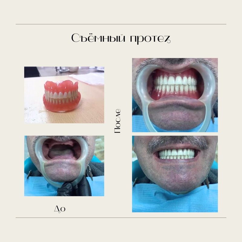 фотография работы Стоматологии 360 на улице Лихоборские Бугры в Коптево
