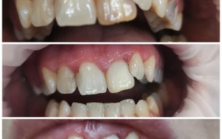 фотография работы врача Ольги Михайловны Бутурлимовой