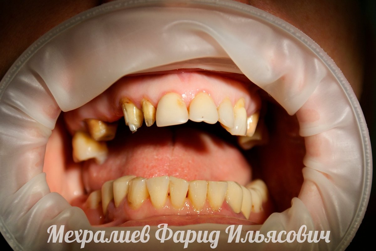 фотография работы Центра здоровья и красоты Медина в Балашихе