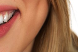 Центр профессиональной стоматологии "Смайл", с рейтингом 3.4 - находится по адресу Республика Марий Эл, Йошкар-Ола, бульвар Чавайна, 13а 