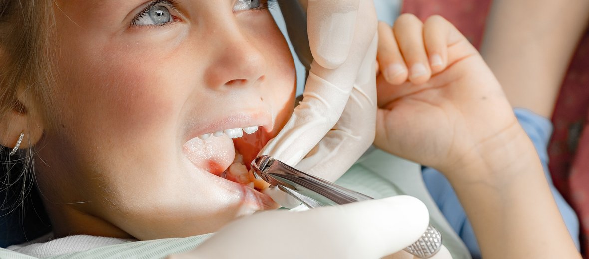 Вырвали молока. Детская стоматология. Вырывание молочных зубов у детей. Молочные зубы выпадывают. Молочные зубы выпадывают.