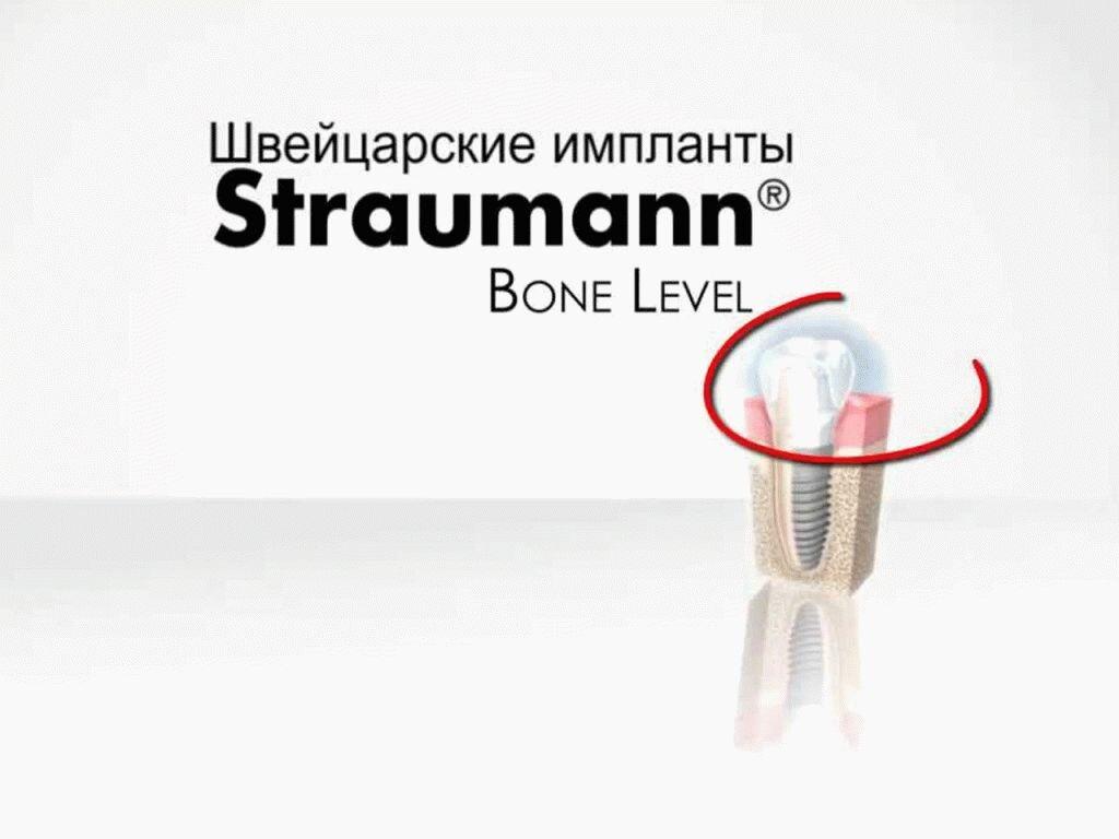 Straumann официально мистер дент. Импланты Швейцария Straumann. Швейцарские импланты Штрауман. Система имплантатов Штрауман. Зубные импланты Швейцария Штрауман.