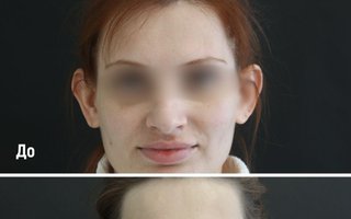 фотография работы врача Валерия Геннадьевича Золотых