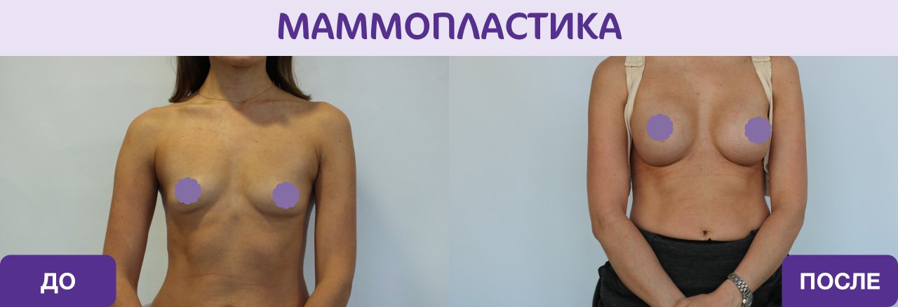 фотография работы Клинического госпиталя MD Group на Севастопольском проспекте