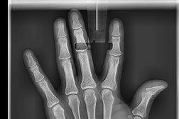 Рентгено-диагностический центр Луч, с рейтингом 3.7 - находится по адресу Санкт-Петербург, Трамвайный проспект, 14 