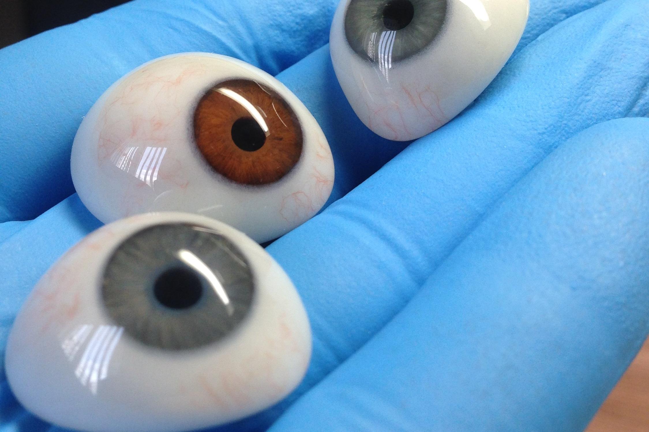 центр протезирования спб. красмед глазное протезирование. красмед глазное протезирование. глазные протезы в крыму. глазное протезирование красмед, красноярск.