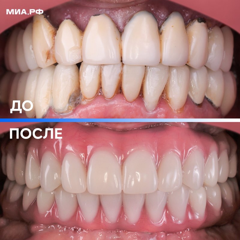 фотография работы Центра имплантации и стоматологии МИА.РФ на метро Рижская