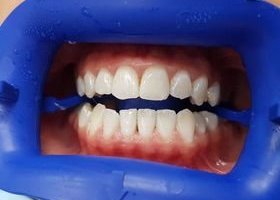 фотография работы врача Лауры Григорьевны Мнацаканян