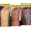 фото от пользователя Диана в отзыве о медицинском центре Скандинавия отделение Северное на улице Ильюшина