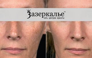 фотография работы врача Анжелики Викторовны Хешы